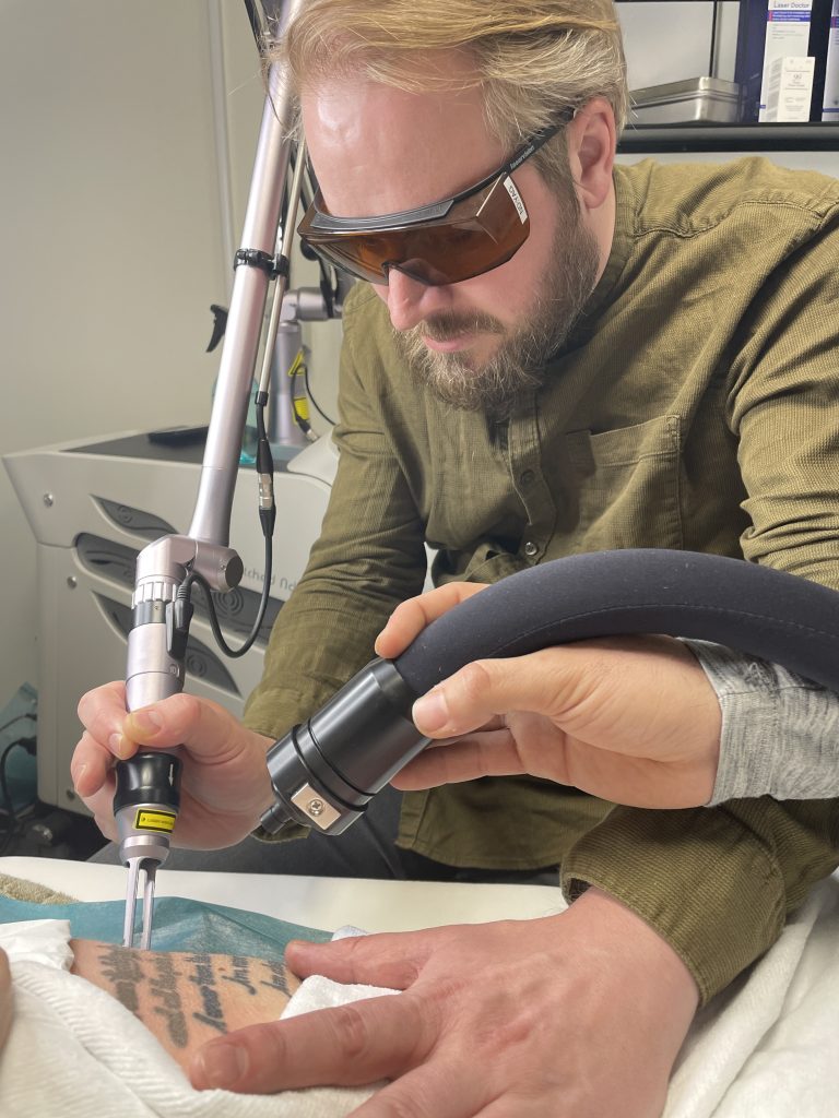 Laser Tattoo Removal Stockholm